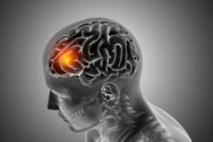 concussion-300x200.jpg
